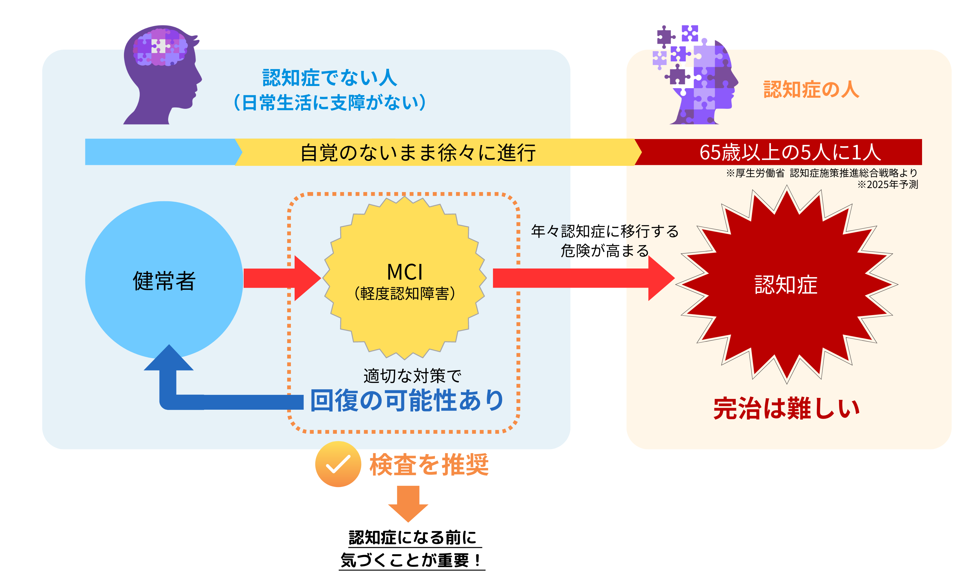”軽度認知障害（MCI）とは”/
