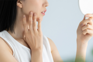 腸内フローラ検査で肌荒れの原因はわかる？検査でわかることや活用方法を解説